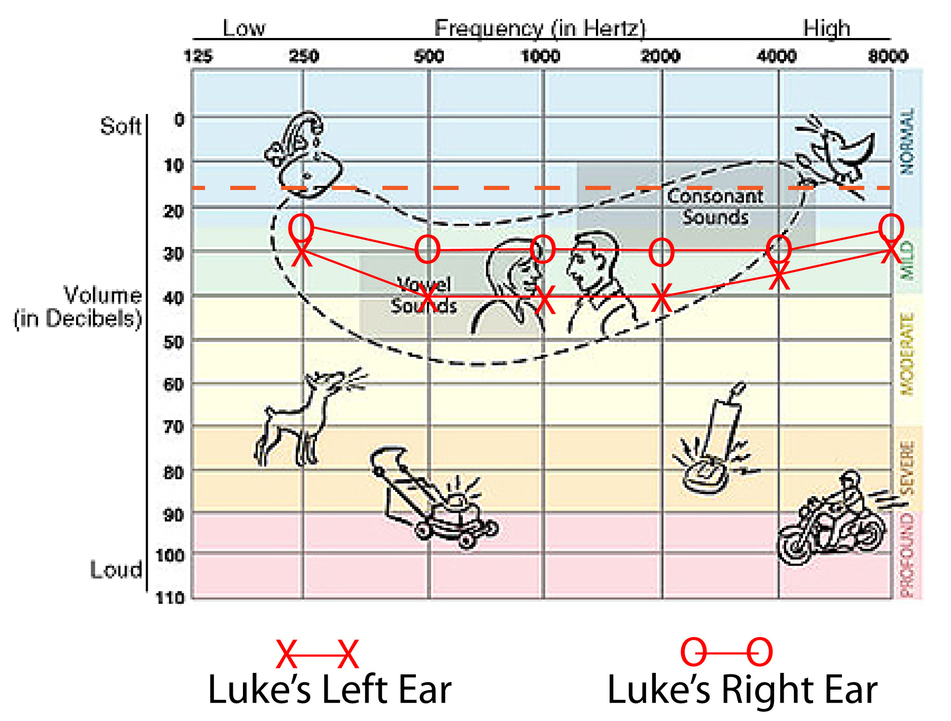Hearing Loss Frequency Chart